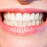 Przepiękne nienaganne zęby dodatkowo olśniewający cudny uśmiech to powód do zadowolenia.